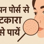ओपन पोर्स से छुटकारा कैसे पायें?